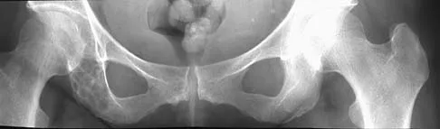 Mtd 2026 MCQs: Board Review Questions & Answers (Part 3) - Figure 91