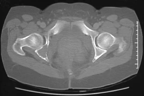 Mtd 2026 MCQs: Board Review Questions & Answers (Part 3) - Figure 93