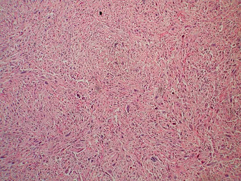 Mtd 2026 MCQs: Board Review Questions & Answers (Part 4) - Figure 109