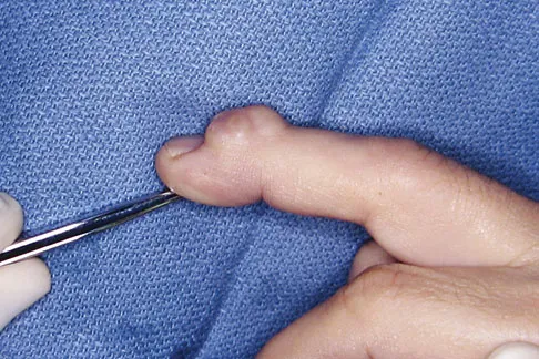 Mtd 2026 MCQs: Board Review Questions & Answers (Part 4) - Figure 113