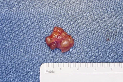 Mtd 2026 MCQs: Board Review Questions & Answers (Part 4) - Figure 115