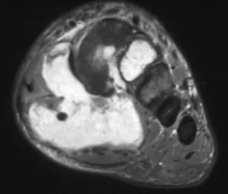 Mtd 2026 MCQs: Board Review Questions & Answers (Part 4) - Figure 125