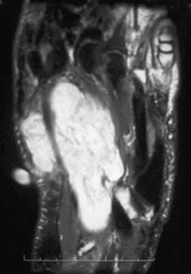 Mtd 2026 MCQs: Board Review Questions & Answers (Part 4) - Figure 127