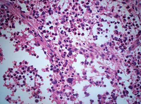 Mtd 2026 MCQs: Board Review Questions & Answers (Part 4) - Figure 133