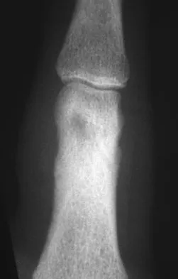 Mtd 2026 MCQs: Board Review Questions & Answers (Part 4) - Figure 137