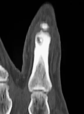 Mtd 2026 MCQs: Board Review Questions & Answers (Part 4) - Figure 139