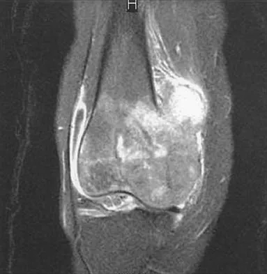 Mtd 2026 MCQs: Board Review Questions & Answers (Part 4) - Figure 33