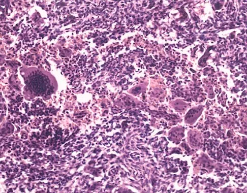 Mtd 2026 MCQs: Board Review Questions & Answers (Part 4) - Figure 35