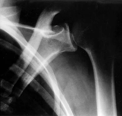 Mtd 2026 MCQs: Board Review Questions & Answers (Part 4) - Figure 47