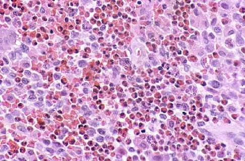 Mtd 2026 MCQs: Board Review Questions & Answers (Part 4) - Figure 55