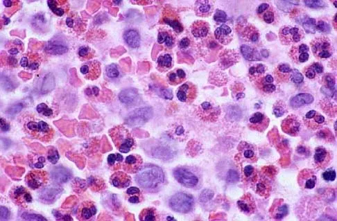 Mtd 2026 MCQs: Board Review Questions & Answers (Part 4) - Figure 57