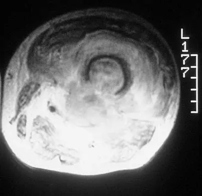 Mtd 2026 MCQs: Board Review Questions & Answers (Part 4) - Figure 61