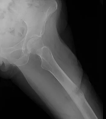 Mtd 2026 MCQs: Board Review Questions & Answers (Part 4) - Figure 79