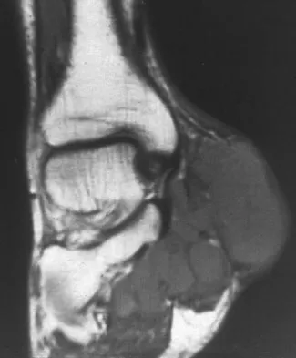 Mtd 2026 MCQs: Board Review Questions & Answers (Part 4) - Figure 95