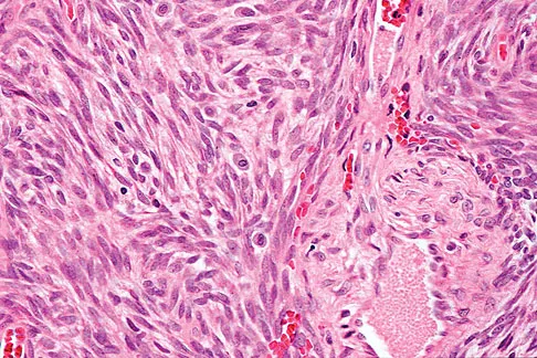 Mtd 2026 MCQs: Board Review Questions & Answers (Part 4) - Figure 99