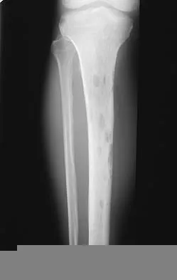 Orthopedic Basic 2026 MCQs: Board Review Questions & Answers (Part 2) - Figure 1