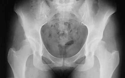 Orthopedic Surgery Board Review 2026 | High-Yield MCQs - Set 1 - Figure 18