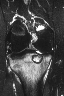 Orthopedic Surgery Board Review 2026 | High-Yield MCQs - Set 1 - Figure 3