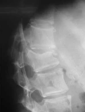 Orthopedic Surgery Board Review 2026 | High-Yield MCQs - Set 1 - Figure 51