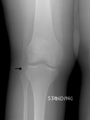 Orthopedic Surgery Board Review 2026 | High-Yield MCQs - Set 1 - Figure 55