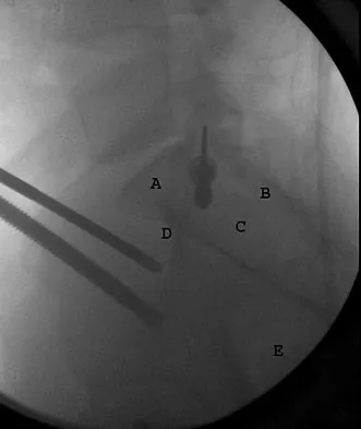 Orthopedic Surgery Board Review 2026 | High-Yield MCQs - Set 1 - Figure 59