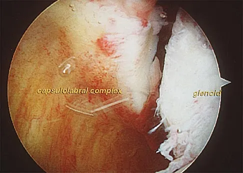 Orthopedic Surgery Board Review 2026 | High-Yield MCQs - Set 1 - Figure 62