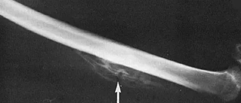 Orthopedic Surgery Board Review 2026 | High-Yield MCQs - Set 1 - Figure 66