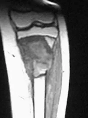 Orthopedic Surgery Board Review 2026 | High-Yield MCQs - Set 1 - Figure 73