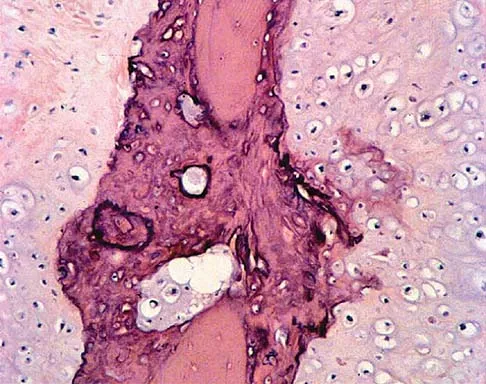 Orthopedic Surgery Board Review 2026 | High-Yield MCQs - Set 1 - Figure 74