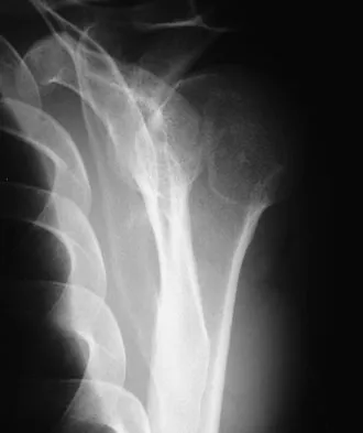 Orthopedic Surgery Board Review 2026 | High-Yield MCQs - Set 1 - Figure 75