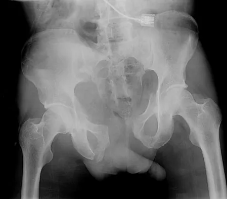 Orthopedic Surgery Board Review 2026 | High-Yield MCQs - Set 1 - Figure 83