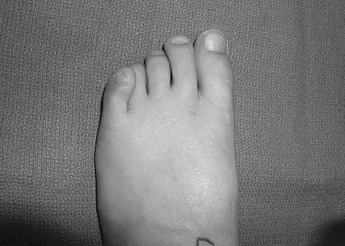 Orthopedic Surgery Board Review 2026 | High-Yield MCQs - Set 1 - Figure 91