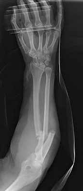 Orthopedic Surgery Board Review 2026 | High-Yield MCQs - Set 10 - Figure 11