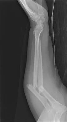 Orthopedic Surgery Board Review 2026 | High-Yield MCQs - Set 10 - Figure 12