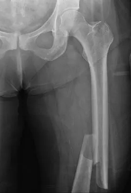 Orthopedic Surgery Board Review 2026 | High-Yield MCQs - Set 10 - Figure 14