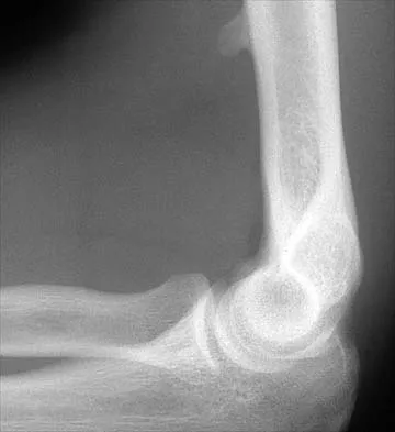 Orthopedic Surgery Board Review 2026 | High-Yield MCQs - Set 10 - Figure 17