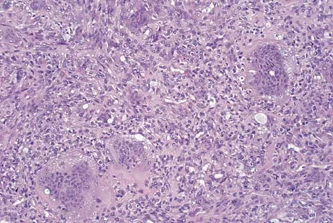 Orthopedic Surgery Board Review 2026 | High-Yield MCQs - Set 10 - Figure 2