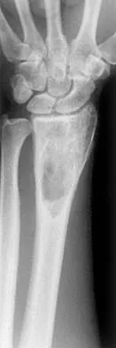 Orthopedic Surgery Board Review 2026 | High-Yield MCQs - Set 10 - Figure 26