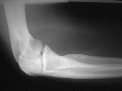 Orthopedic Surgery Board Review 2026 | High-Yield MCQs - Set 10 - Figure 3