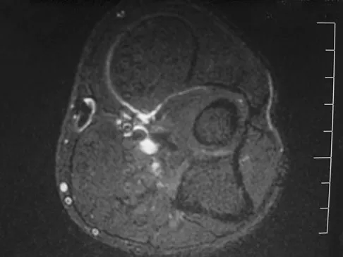 Orthopedic Surgery Board Review 2026 | High-Yield MCQs - Set 10 - Figure 5