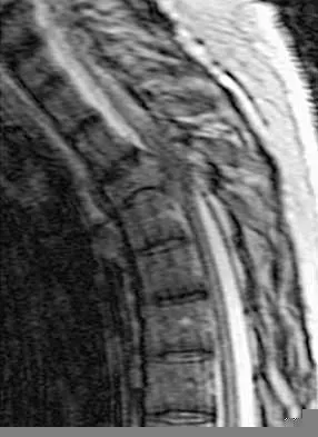 Orthopedic Surgery Board Review 2026 | High-Yield MCQs - Set 2 Figure 1