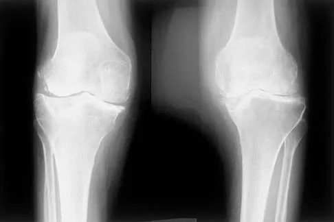 Orthopedic Surgery Board Review 2026 | High-Yield MCQs - Set 2 - Figure 103