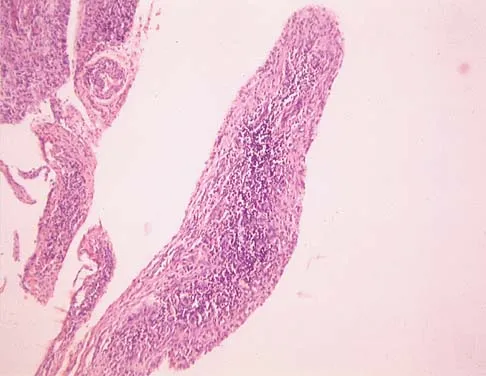 Orthopedic Surgery Board Review 2026 | High-Yield MCQs - Set 2 - Figure 104