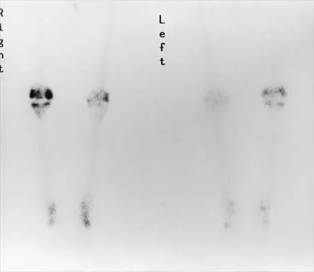 Orthopedic Surgery Board Review 2026 | High-Yield MCQs - Set 2 - Figure 120