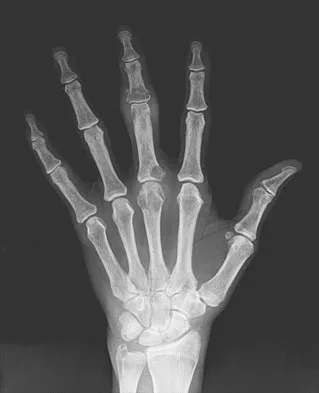 Orthopedic Surgery Board Review 2026 | High-Yield MCQs - Set 2 - Figure 19