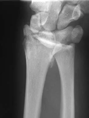 Orthopedic Surgery Board Review 2026 | High-Yield MCQs - Set 2 - Figure 29