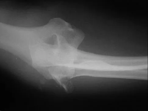 Orthopedic Surgery Board Review 2026 | High-Yield MCQs - Set 2 - Figure 3