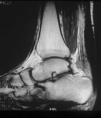 Orthopedic Surgery Board Review 2026 | High-Yield MCQs - Set 2 - Figure 48