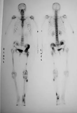 Orthopedic Surgery Board Review 2026 | High-Yield MCQs - Set 2 - Figure 54