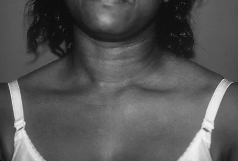 Orthopedic Surgery Board Review 2026 | High-Yield MCQs - Set 2 - Figure 74